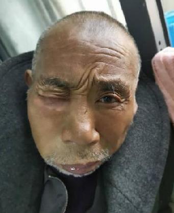 走失者照片 全国救助站
