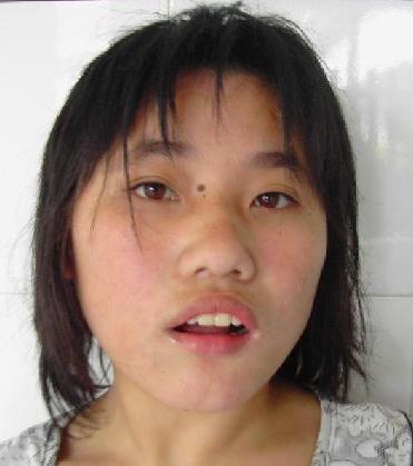走失者照片 全国救助站