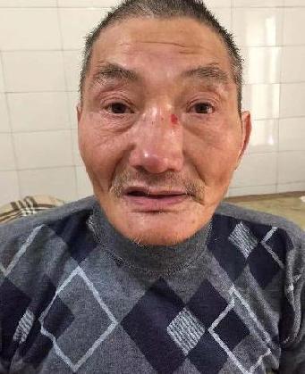 走失者照片 全国救助站