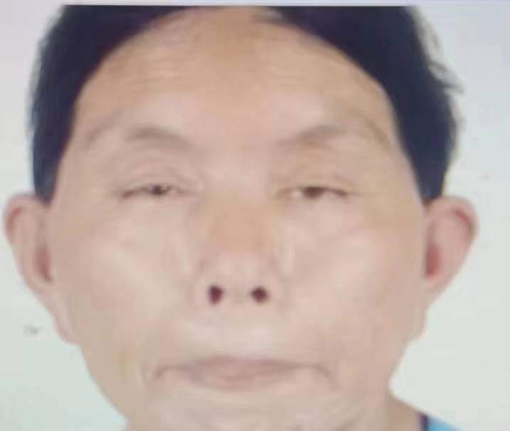 走失者照片 【寻人】杨某芬，女，65岁，202...
