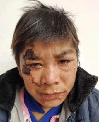 走失者照片 全国救助站