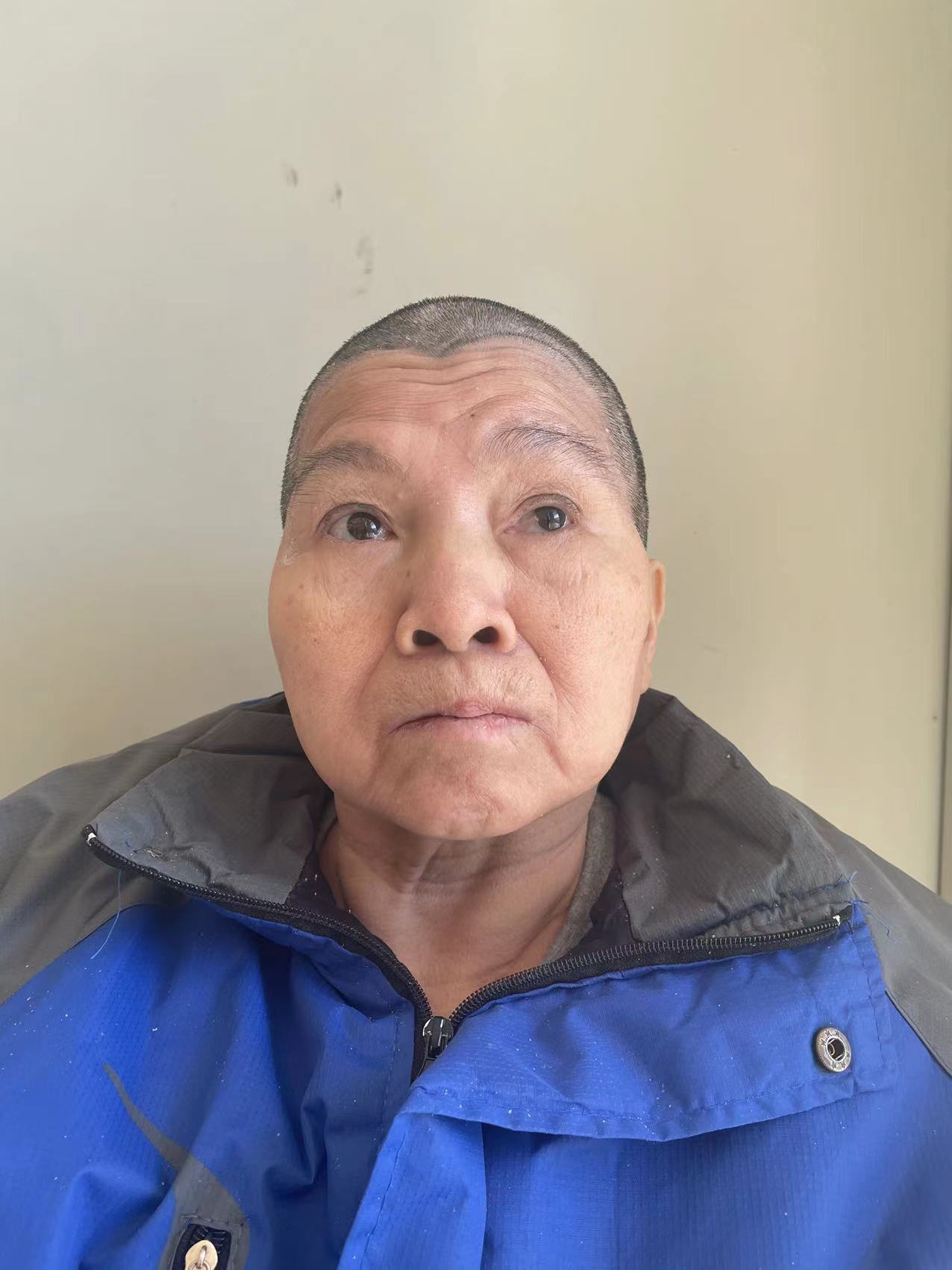走失者照片 全国救助站