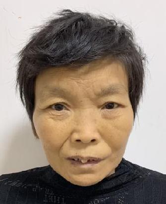 走失者照片 全国救助站