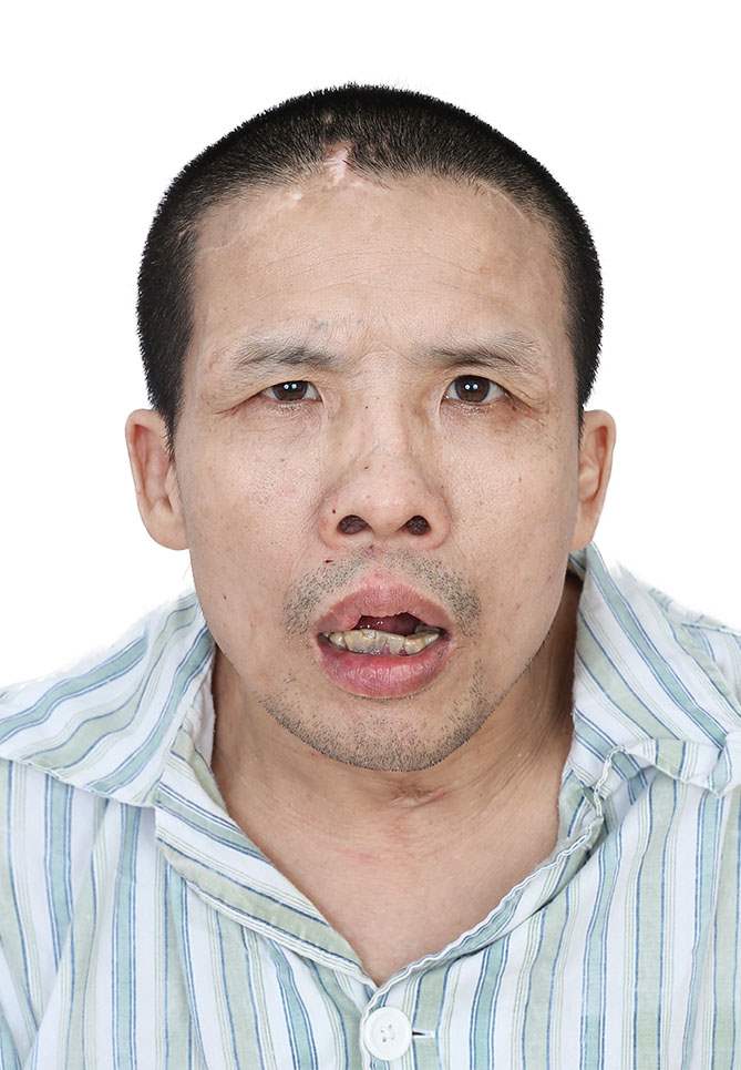 走失者照片 全国救助站