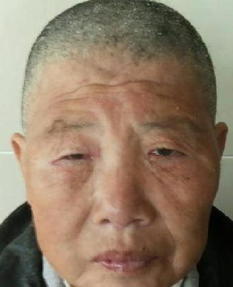 走失者照片 全国救助站