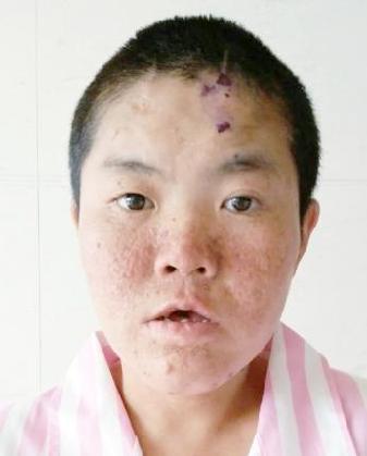走失者照片 全国救助站