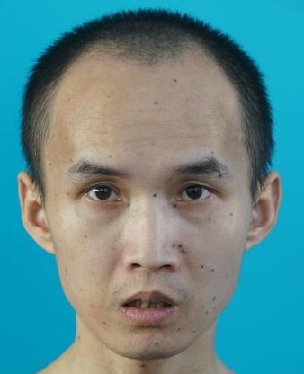 走失者照片 全国救助站