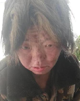 走失者照片 全国救助站