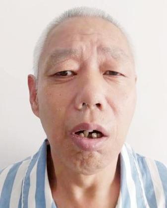走失者照片 全国救助站