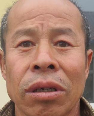 走失者照片 全国救助站