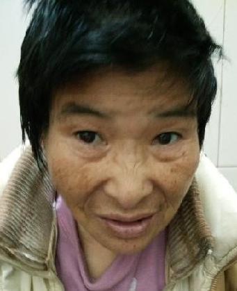 走失者照片 全国救助站