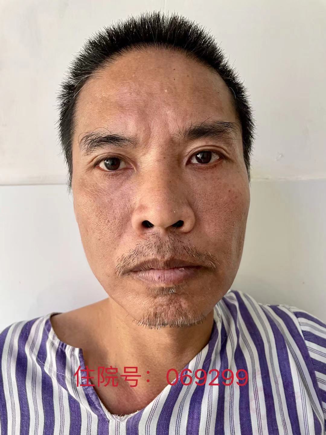 走失者照片 全国救助站