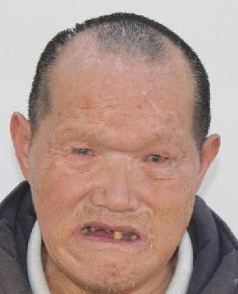 走失者照片 全国救助站