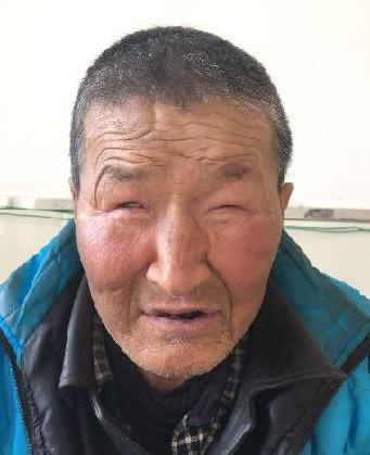 走失者照片 全国救助站