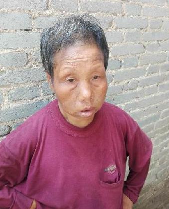 走失者照片 全国救助站
