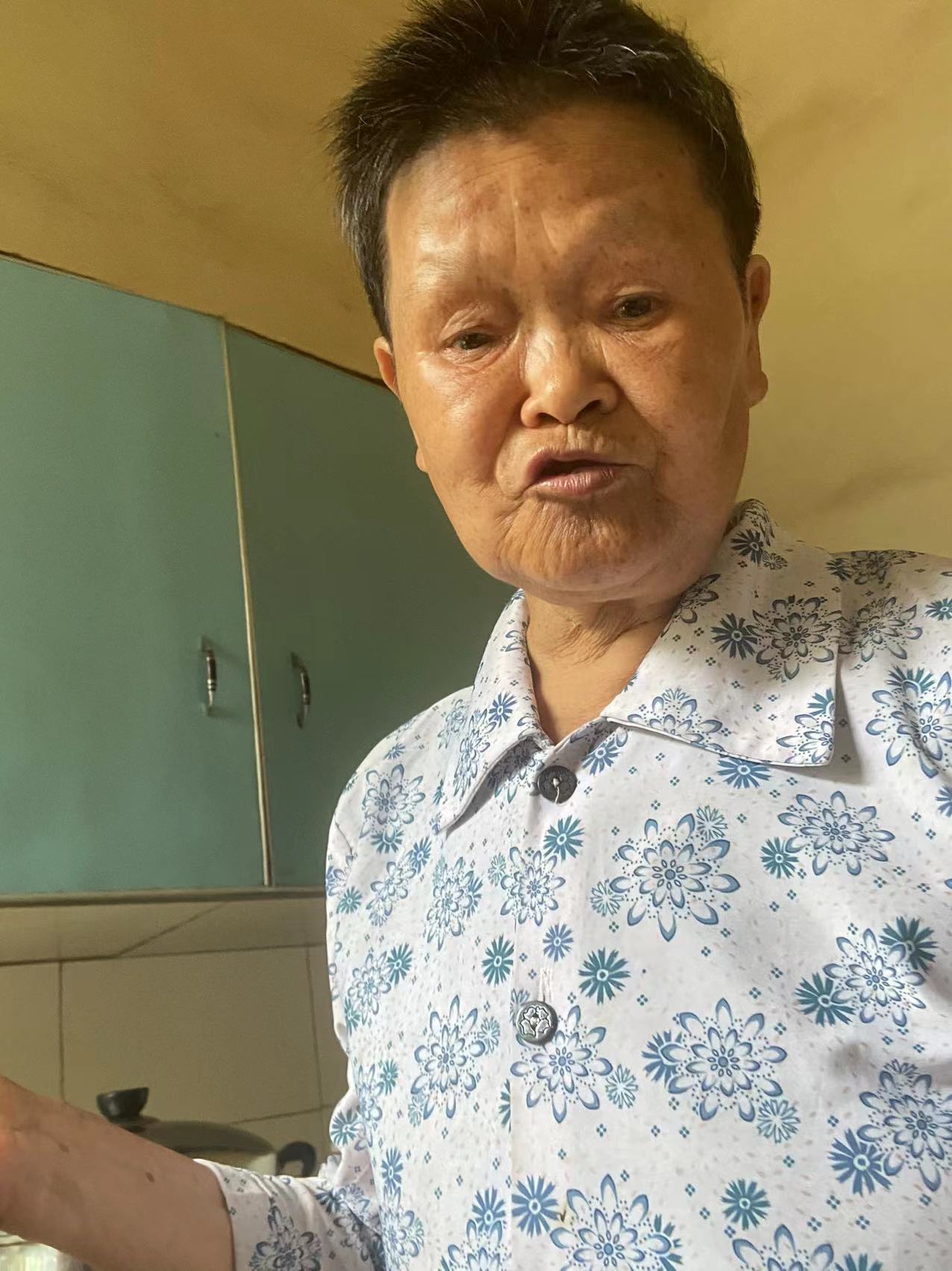 走失者照片 向朝珍、女、 74 岁，因本人老年...
