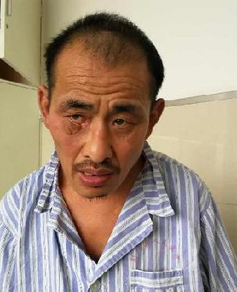 走失者照片 全国救助站