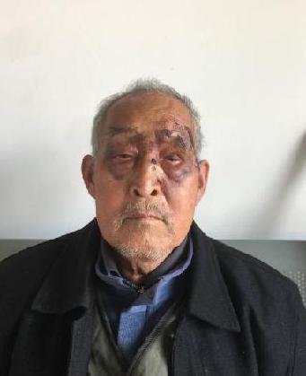 走失者照片 全国救助站