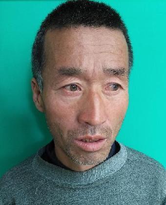 走失者照片 全国救助站