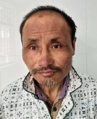 走失者照片 全国救助站