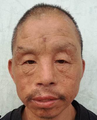 走失者照片 全国救助站