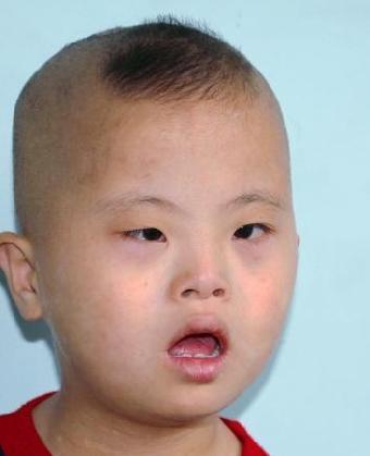 走失者照片 全国救助站