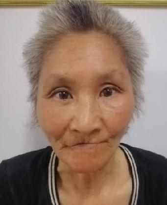 走失者照片 全国救助站