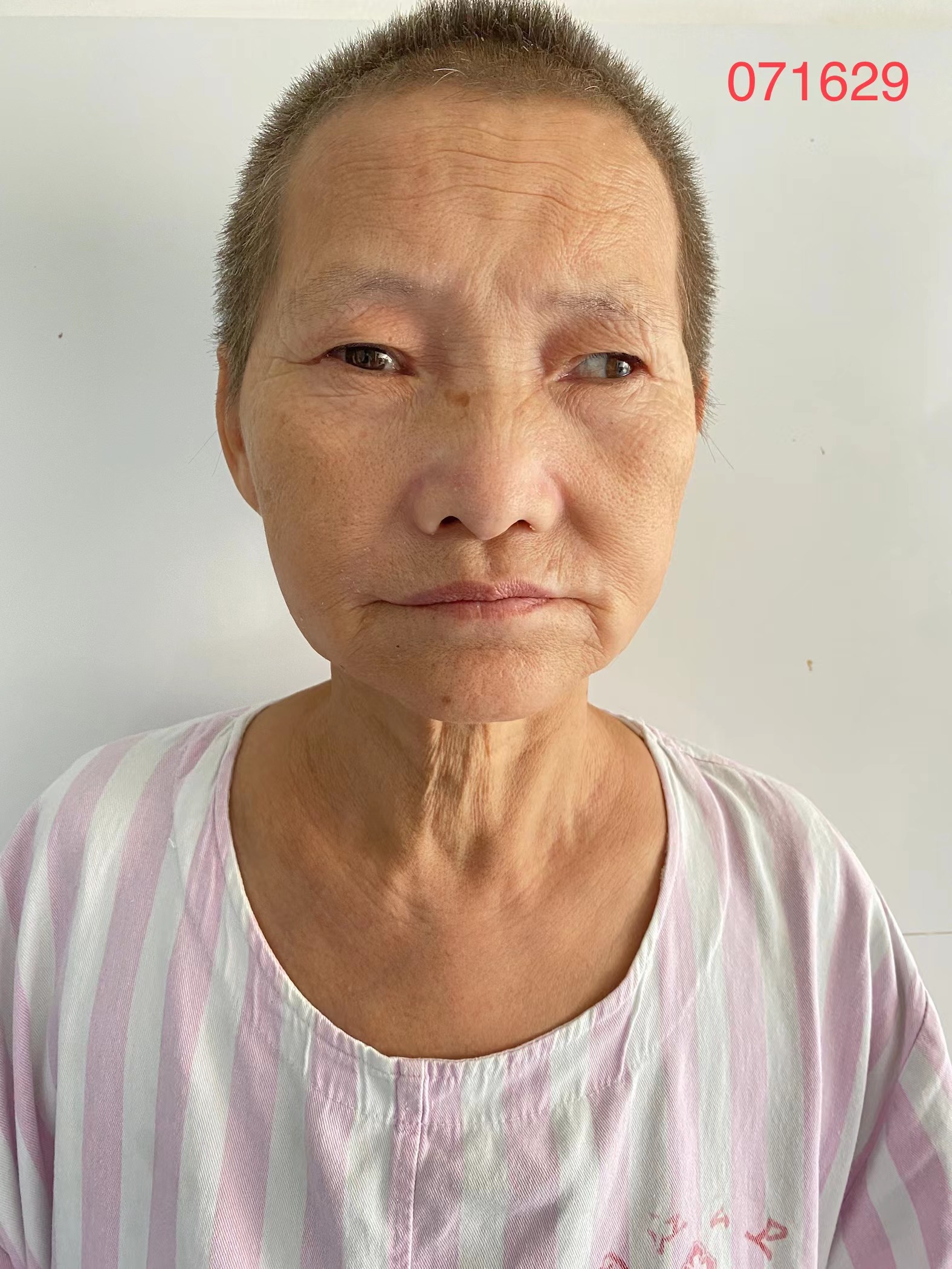 走失者照片 全国救助站