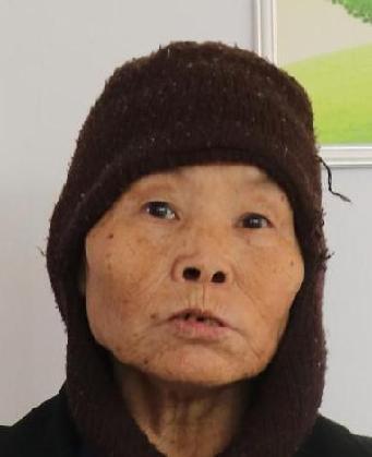 走失者照片 全国救助站