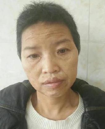 走失者照片 全国救助站
