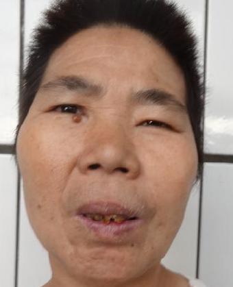 走失者照片 全国救助站