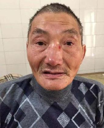 走失者照片 全国救助站