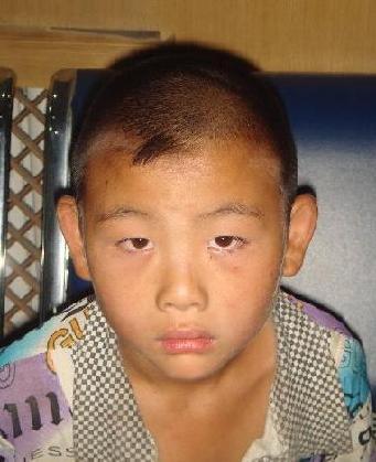 走失者照片 全国救助站