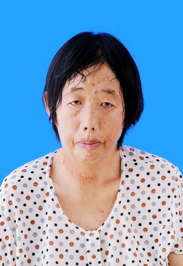 走失者照片 寻找家人