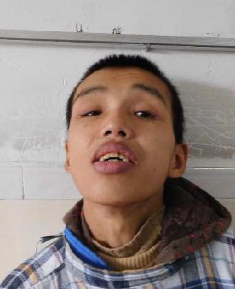 走失者照片 全国救助站