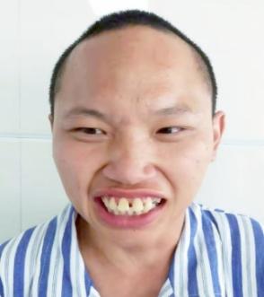 走失者照片 全国救助站