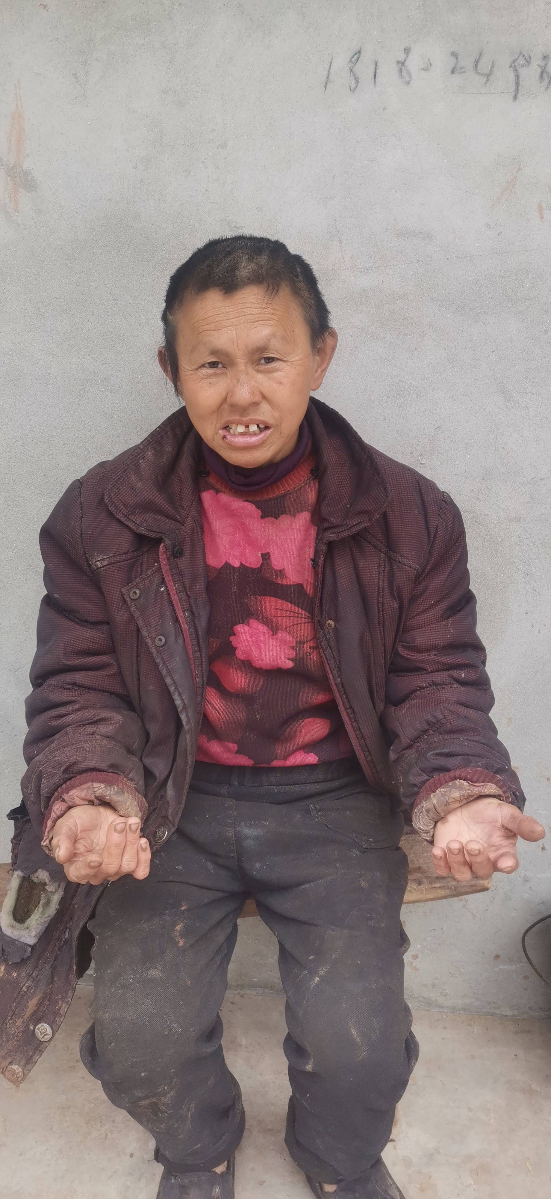 走失者照片 感谢各位好心人，如有看见请联系本人