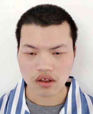 走失者照片 全国救助站