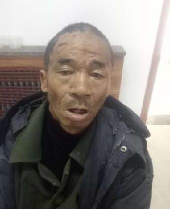 走失者照片 全国救助站