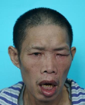 走失者照片 全国救助站