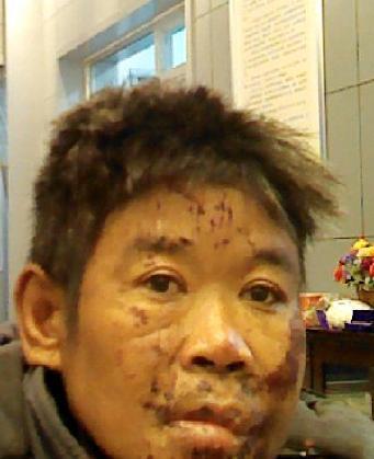 走失者照片 全国救助站