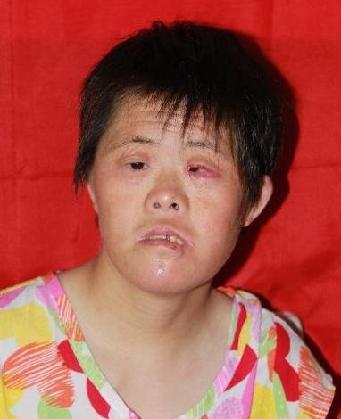 走失者照片 全国救助站