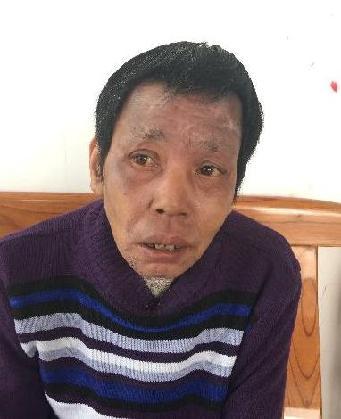 走失者照片 全国救助站