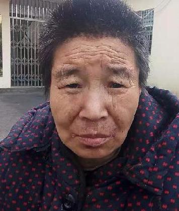 走失者照片 全国救助站