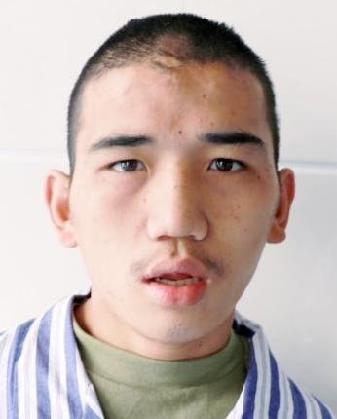 走失者照片 全国救助站