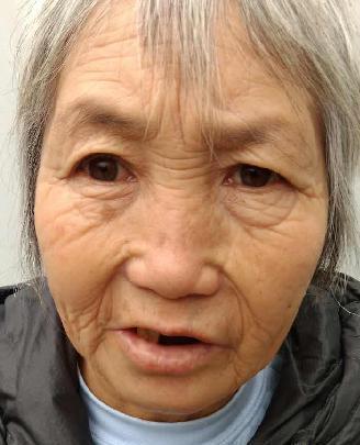 走失者照片 全国救助站