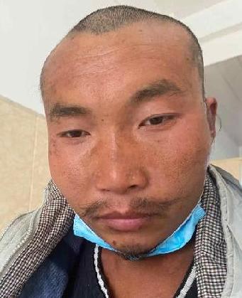 走失者照片 全国救助站