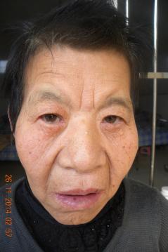 走失者照片 全国救助站