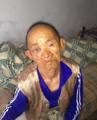 走失者照片 全国救助站
