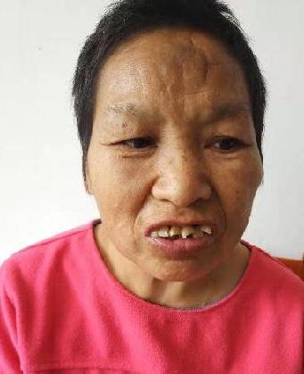 走失者照片 全国救助站